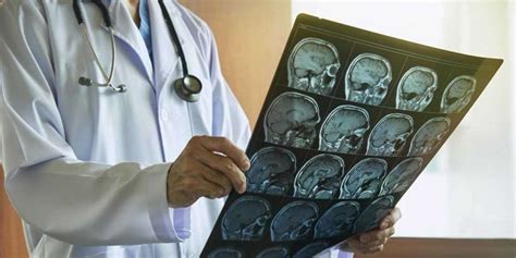 beyin cerrahi hangi hastalara bakar